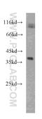 Renalase, FAD Dependent Amine Oxidase antibody, 60128-1-Ig, Proteintech Group, Western Blot image 