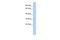 LY6/PLAUR Domain Containing 4 antibody, A17518, Boster Biological Technology, Western Blot image 