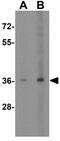 G Protein-Coupled Receptor 3 antibody, GTX31380, GeneTex, Western Blot image 