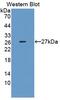 Chromatin Assembly Factor 1 Subunit B antibody, LS-C689156, Lifespan Biosciences, Western Blot image 