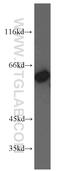 Inosine Monophosphate Dehydrogenase 2 antibody, 55398-1-AP, Proteintech Group, Western Blot image 