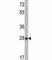 Insulin Like Growth Factor Binding Protein 6 antibody, F49850-0.4ML, NSJ Bioreagents, Immunohistochemistry paraffin image 