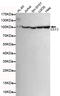 Eukaryotic Translation Elongation Factor 2 antibody, MBS475027, MyBioSource, Western Blot image 