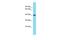 Protein-L-Isoaspartate (D-Aspartate) O-Methyltransferase Domain Containing 2 antibody, PA5-69557, Invitrogen Antibodies, Western Blot image 