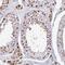 Testis-specific basic protein Y 1 antibody, PA5-60888, Invitrogen Antibodies, Immunohistochemistry frozen image 