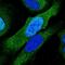 Proteasome 26S Subunit, ATPase 6 antibody, PA5-60140, Invitrogen Antibodies, Immunofluorescence image 