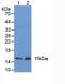 Trefoil Factor 2 antibody, LS-C296796, Lifespan Biosciences, Western Blot image 