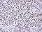 Apoptosis Enhancing Nuclease antibody, NBP1-31700, Novus Biologicals, Immunohistochemistry paraffin image 