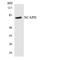 Non-SMC Condensin I Complex Subunit H antibody, LS-C200255, Lifespan Biosciences, Western Blot image 