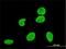 VPS8 Subunit Of CORVET Complex antibody, H00023355-M01, Novus Biologicals, Immunofluorescence image 