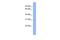 Claudin 18 antibody, GTX47159, GeneTex, Western Blot image 