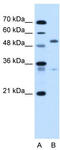 Podocalyxin Like antibody, TA335715, Origene, Western Blot image 
