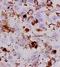 Preferentially Expressed Antigen In Melanoma antibody, orb100949, Biorbyt, Immunohistochemistry paraffin image 