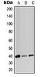 Adh-3 antibody, GTX54902, GeneTex, Western Blot image 