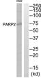 PARP2 antibody, abx014053, Abbexa, Western Blot image 