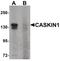 CASK Interacting Protein 1 antibody, PA5-34424, Invitrogen Antibodies, Western Blot image 