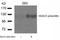 Histone Deacetylase 5 antibody, GTX50238, GeneTex, Western Blot image 