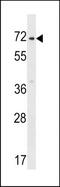 Zinc Finger Protein 155 antibody, TA324612, Origene, Western Blot image 