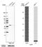Cyclin Dependent Kinase 7 antibody, HPA007932, Atlas Antibodies, Western Blot image 