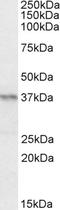 Paired Box 4 antibody, EB09787, Everest Biotech, Western Blot image 