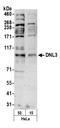 DNA Ligase 3 antibody, A301-637A, Bethyl Labs, Western Blot image 