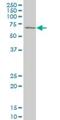 Ribosomal Protein S6 Kinase B1 antibody, H00006198-M03, Novus Biologicals, Western Blot image 