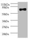 Deoxynucleoside triphosphate triphosphohydrolase SAMHD1  antibody, orb243462, Biorbyt, Western Blot image 