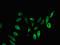 Collagen Type IV Alpha 3 Binding Protein antibody, LS-C398202, Lifespan Biosciences, Immunofluorescence image 