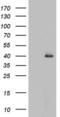 Histone Deacetylase 11 antibody, LS-C339183, Lifespan Biosciences, Western Blot image 