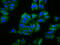 Beaded Filament Structural Protein 2 antibody, CSB-PA615697LA01HU, Cusabio, Immunofluorescence image 