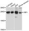 VHL Binding Protein 1 antibody, A8990, ABclonal Technology, Western Blot image 