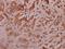 Insulin Receptor Substrate 1 antibody, A00268Y632, Boster Biological Technology, Immunohistochemistry frozen image 