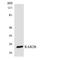 RAB2B, Member RAS Oncogene Family antibody, LS-C200551, Lifespan Biosciences, Western Blot image 