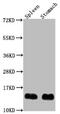 Beta-2-Microglobulin antibody, CSB-PA002486LA01MO, Cusabio, Western Blot image 