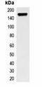 Methyltransferase Like 7A antibody, orb75096, Biorbyt, Immunoprecipitation image 