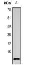 Pancreatic secretory trypsin inhibitor antibody, orb382054, Biorbyt, Western Blot image 