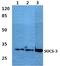 Suppressor Of Cytokine Signaling 3 antibody, A00274, Boster Biological Technology, Western Blot image 