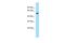 Nicotinate Phosphoribosyltransferase antibody, PA5-70595, Invitrogen Antibodies, Western Blot image 