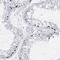 Transmembrane And Coiled-Coil Domains 6 antibody, NBP1-83464, Novus Biologicals, Immunohistochemistry paraffin image 