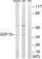 Growth Differentiation Factor 15 antibody, LS-C120016, Lifespan Biosciences, Western Blot image 