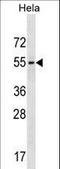 Galanin Receptor 3 antibody, LS-C166367, Lifespan Biosciences, Western Blot image 