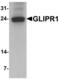 GLI Pathogenesis Related 1 antibody, LS-C201173, Lifespan Biosciences, Western Blot image 