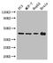 Alpha-Methylacyl-CoA Racemase antibody, LS-C498379, Lifespan Biosciences, Western Blot image 