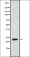 PPP1R2 Family Member B antibody, orb338578, Biorbyt, Western Blot image 