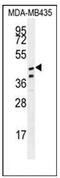 Sterile alpha motif domain-containing protein 7 antibody, AP53792PU-N, Origene, Western Blot image 