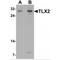 T Cell Leukemia Homeobox 2 antibody, MBS153405, MyBioSource, Western Blot image 