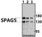 Sperm Associated Antigen 5 antibody, A07062, Boster Biological Technology, Western Blot image 