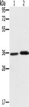 Phytanoyl-CoA dioxygenase, peroxisomal antibody, TA350283, Origene, Western Blot image 