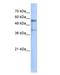 Kringle Containing Transmembrane Protein 1 antibody, NBP1-59371, Novus Biologicals, Western Blot image 