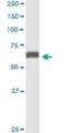 Nectin Cell Adhesion Molecule 2 antibody, H00005819-M01, Novus Biologicals, Immunoprecipitation image 